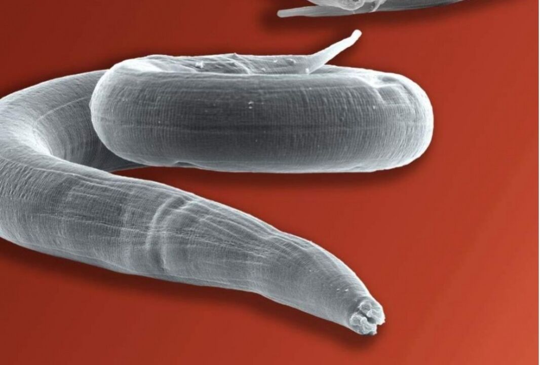 pinworm z lidského těla
